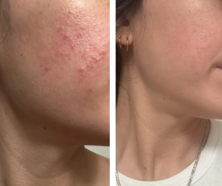 Turmeric & Honey Soap