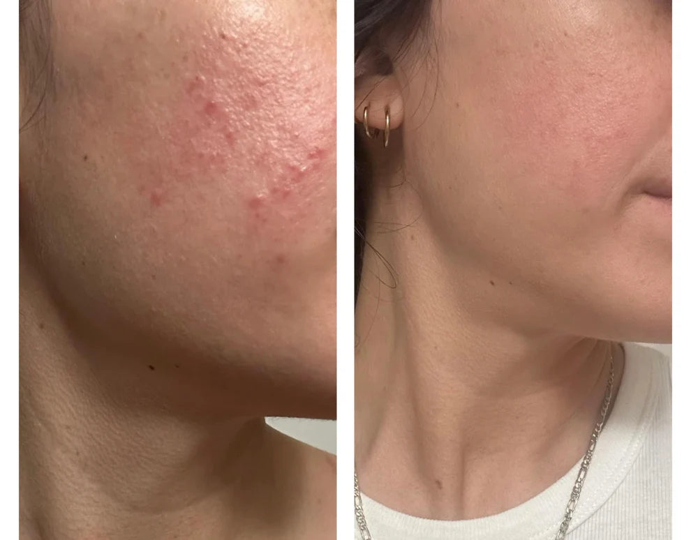 Foaming Face Wash – Cleanse, Soothe & Glow Naturally